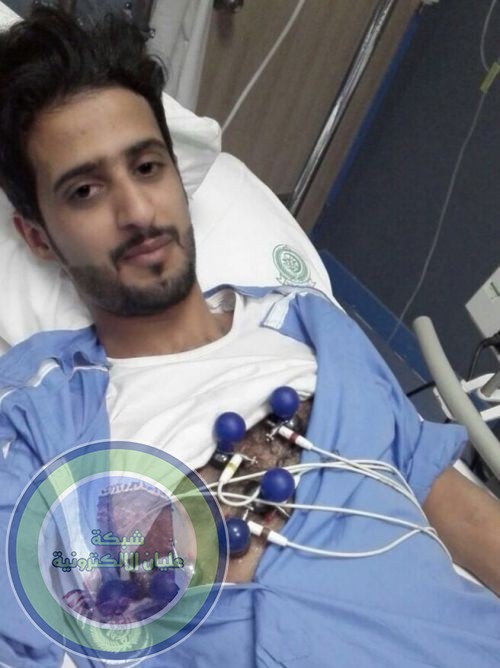 إبراهيم مسفر العلياني يتبرع بكليته للطفل الأكلبي